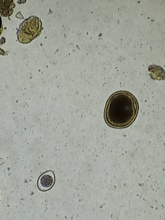 Huevo de Toxocara y ooquiste de Coccidias