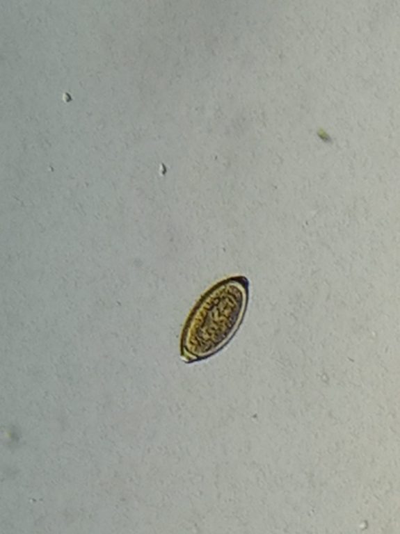 Trichuris